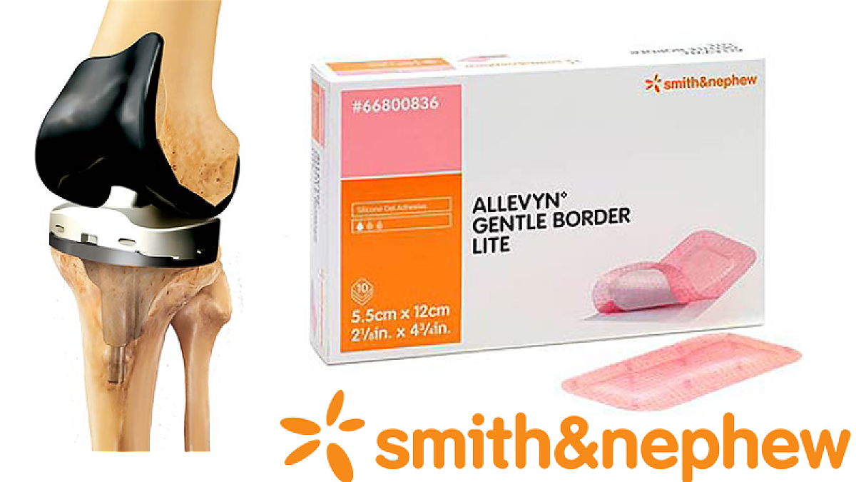 Smith & Nephew Gestion et distribution efficaces des documents médicaux
